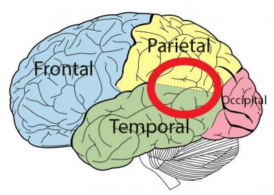 27d46017e2 73541 temporoparietal junction diagram 2