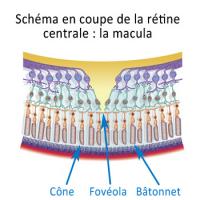 Schema coupe macula 1